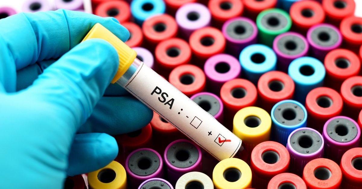 tubos de exame de sangue - PSA alterado